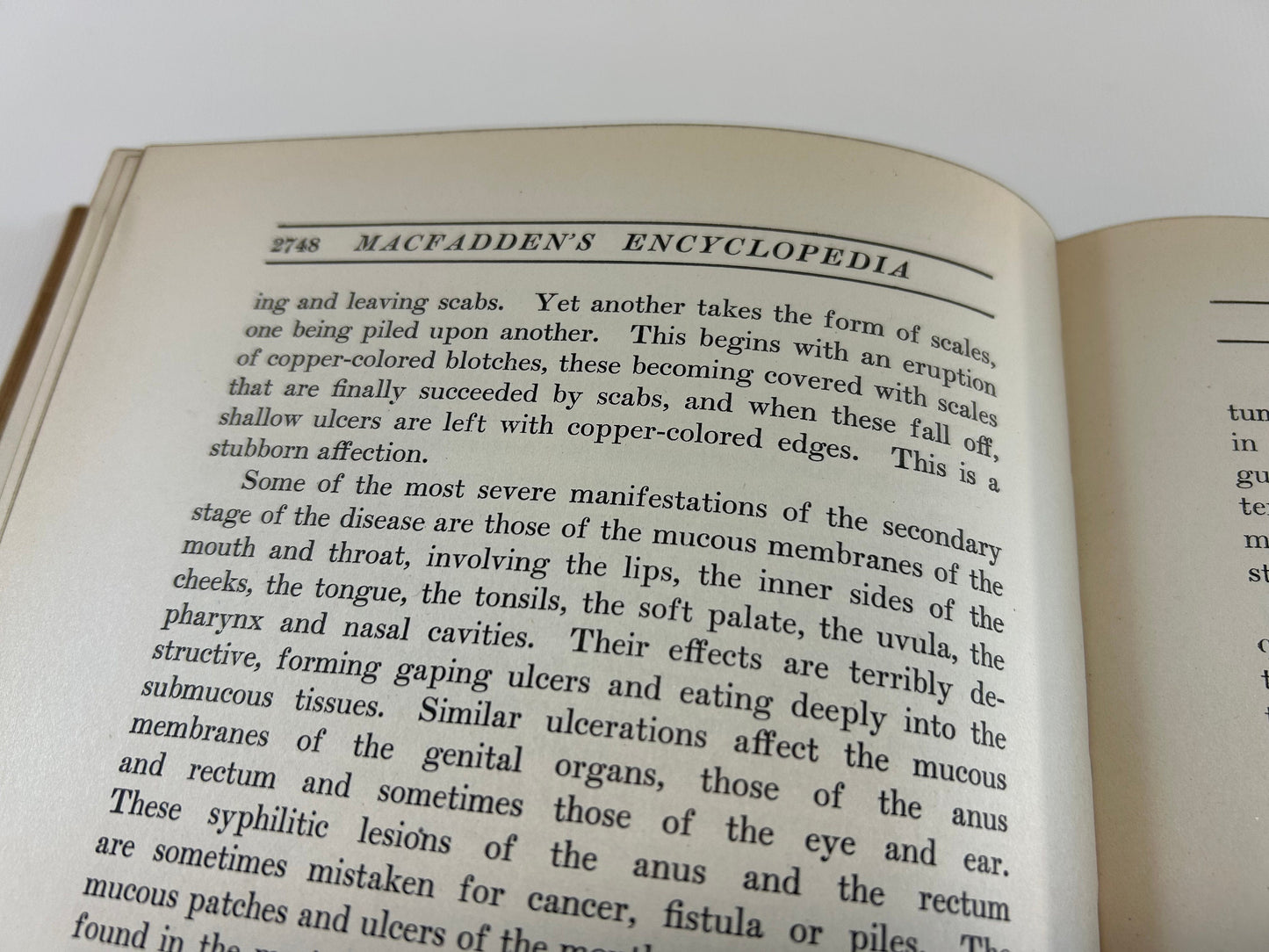 Antique Reference Book MacFadden's Encyclopedia Of Physical Culture Volume V Five Natural Methods Of Healing Anatomy Physiology Human Body